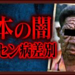 日本におけるハンセン病の現状と取り組み