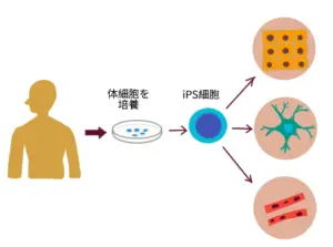 ips細胞 — JP news