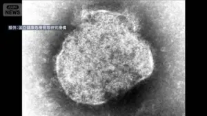 感染 — JP news
